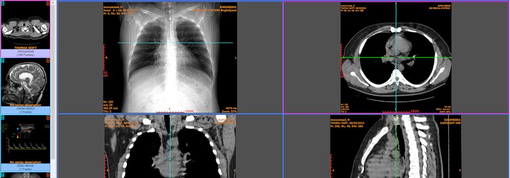 PACS-Imaging-Software-on-HighQualityBlog