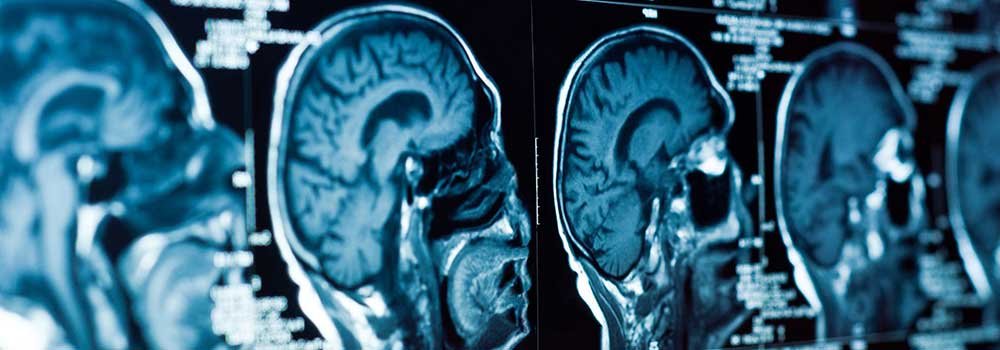 Medical-Imaging-System-on-HighQualityBlog
